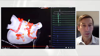 tmb Ep Fellows presentation