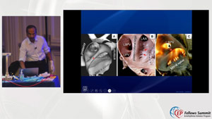 tmb epfs2023 Device Troubleshooting